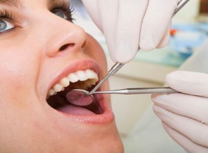 Teeth-Cleaning-2