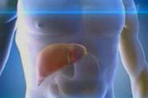 Цирроз печени: стадии и признаки цирроза