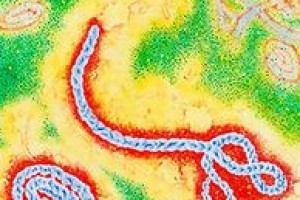 Вирус Эбола будут диагностировать за 15 минут
