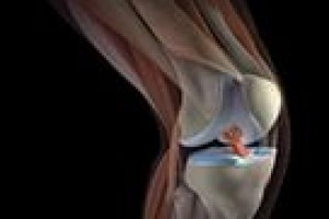Особенности МРТ-диагностики коленного сустава
