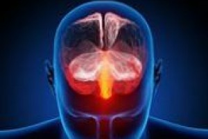 Воспаление в мозгу провоцирует хроническую мигрень и депрессию
