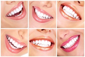Отбеливание зубов в домашних условиях