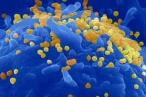 Учёные находят новые способы борьбы c заболеванием ВИЧ