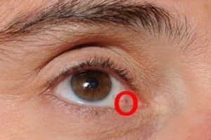 Онкология глаза: симптомы, причины и лечение