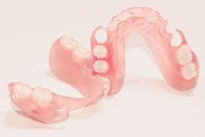 Альтернатива зубным протезам есть