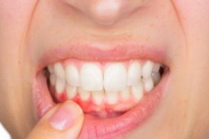 Где лучше лечить больные зубы