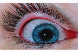 Механические повреждения глаз