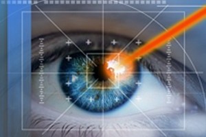 Методики лазерной коррекции зрения