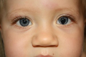 В чем главная опасность болезней глаз у детей